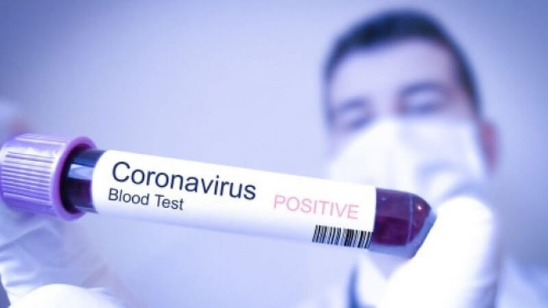 Viêm hô hấp cấp do Corona virus
